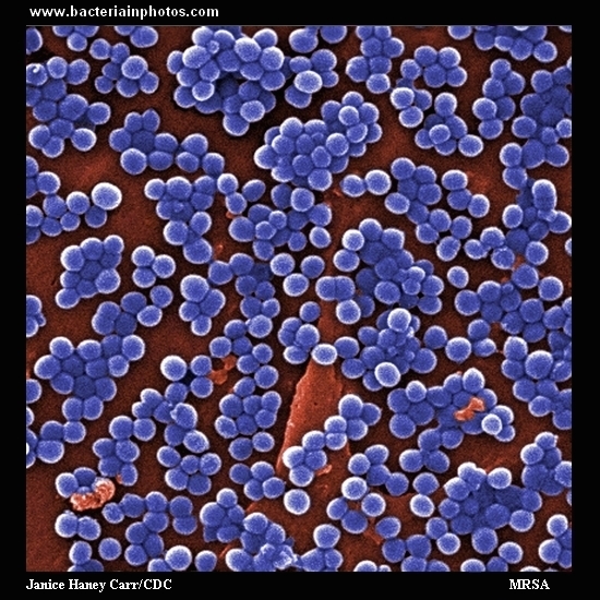 Methicillin Resistant Staphylococcus Aureus Mrsa Under Microscope Morphology And Microscopic 3559